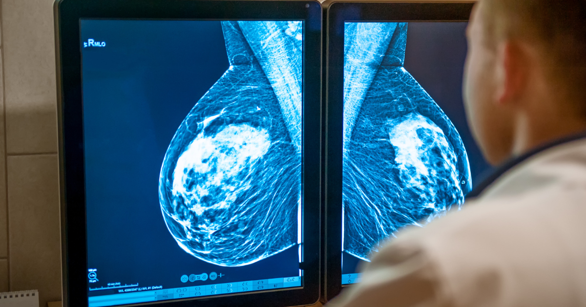 Mammogram Results What is Breast Density and Why Should You Care
